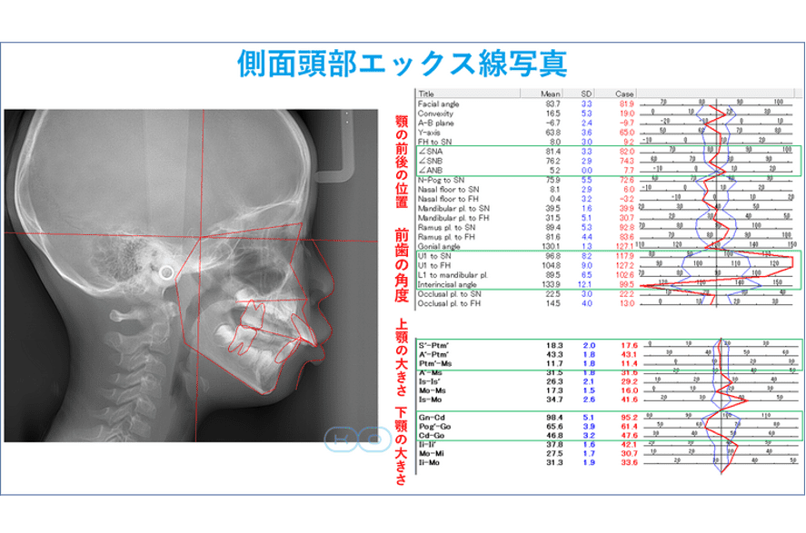 側面頭部エックス線写真