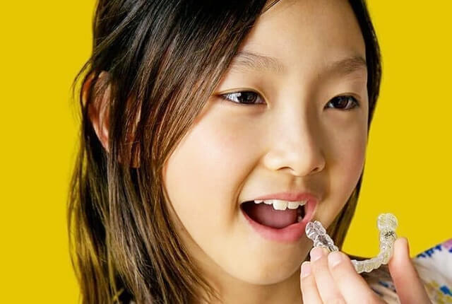 子どものマウスピース矯正
